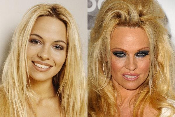 Before And After Pictures Of The Celebrities Who Chose To Spoil Their Own Looks
