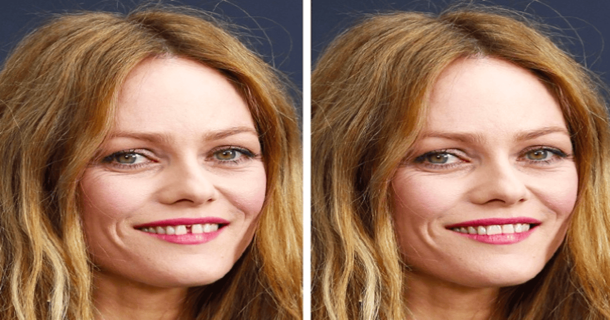 Celebrities Look If Their Distinctive Feature Is Missing