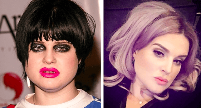 Celebrities Who Overcame Their Addiction And Made Triumphant