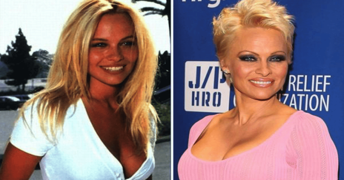 10 Famous Celebrities Who Didn't Age Gracefully