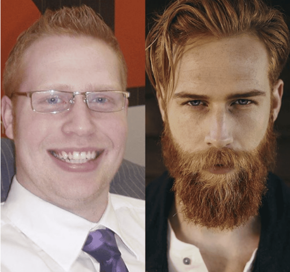 10 Pictures That Proves Why Women Prefer Beard Guys