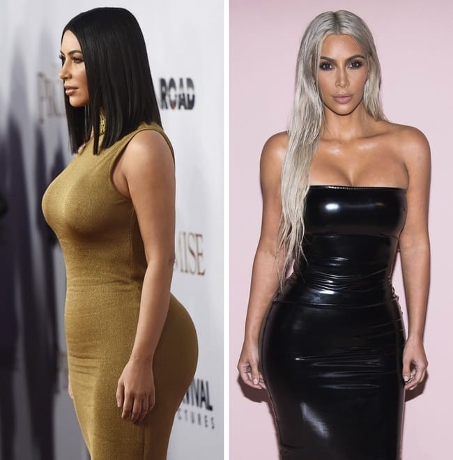 7 Famous Personalities Who Ruled Even Though Their Body Had Certain Flaws