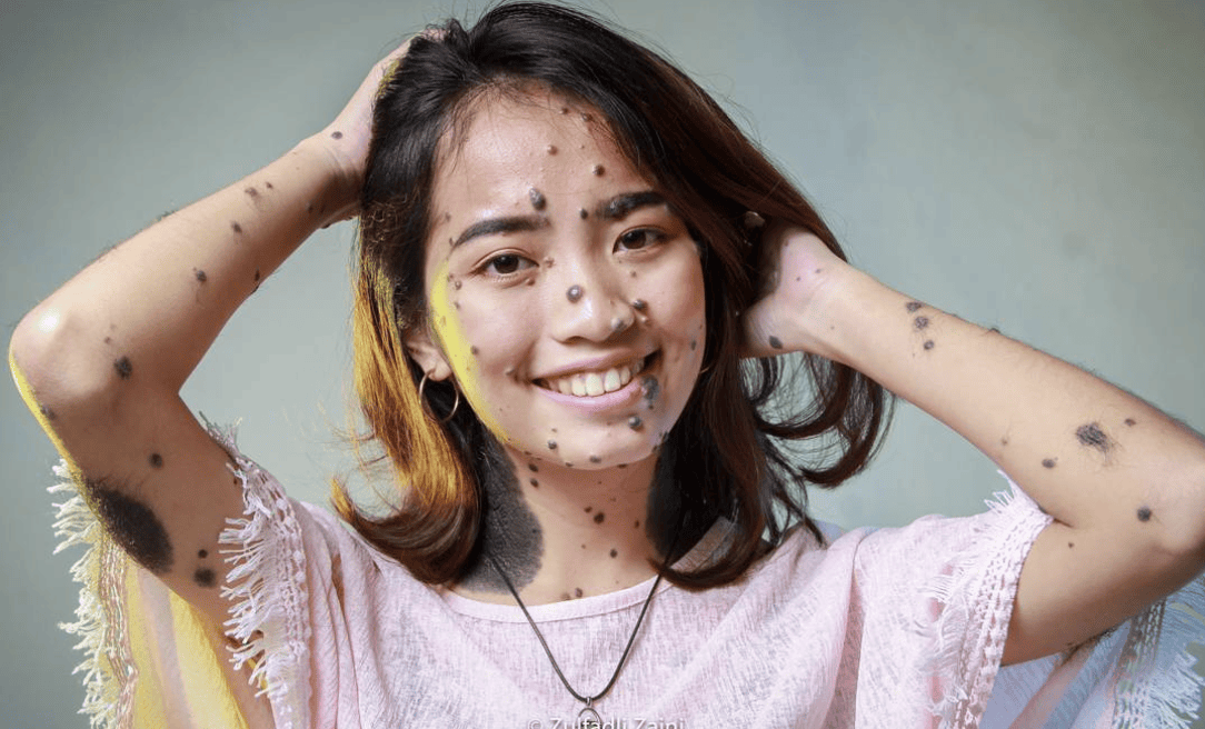 8 Times People Broke The Myth Of Beauty