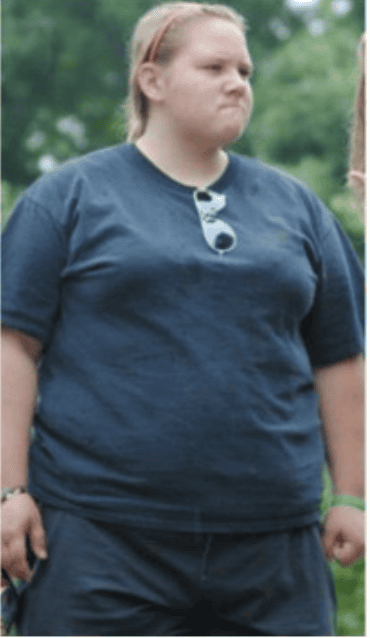 Woman Loses 70 Kg After Her Crush Rejected Her For Her Appearance