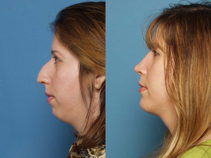 Most Expensive Plastic Surgery Procedures