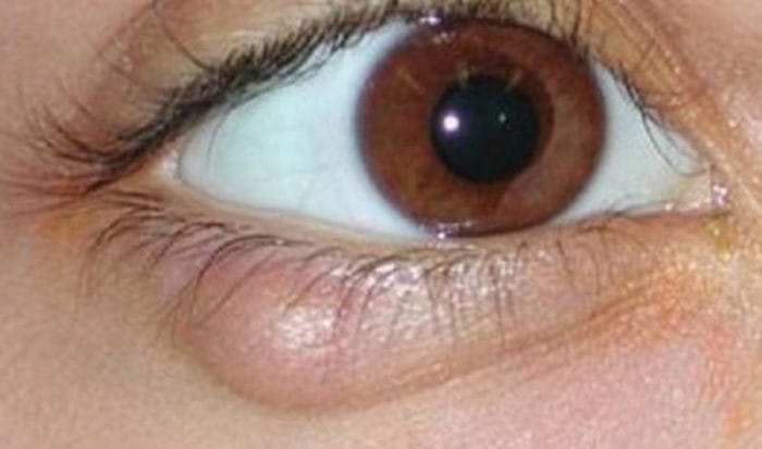 10 Things Your Eyes Can Tell You About Your Health