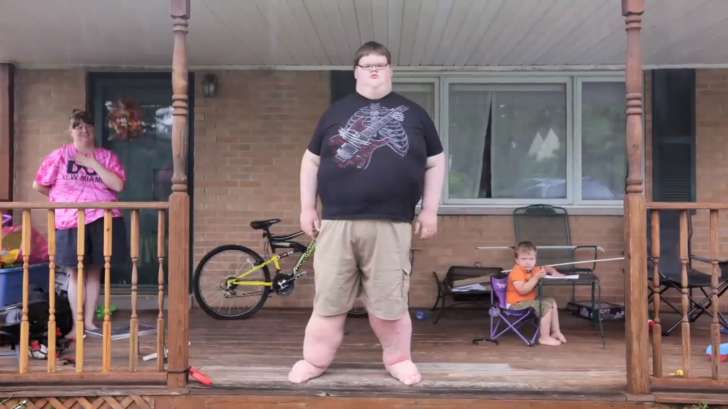 At Only 15 Years Old, He Weighed 707 Pounds, When You See Him Today!