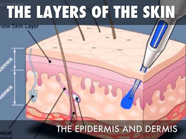 Ever Wondered What Happens To Tattoos When You Remove Them?