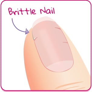 Her Nails Were Dotted With Little White Marks.The Reason?I Had No Idea