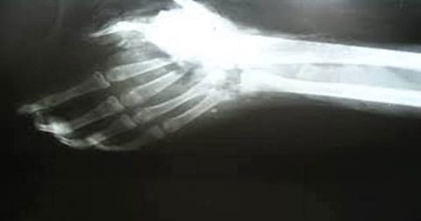 Here Are 10 Facts About Left-Handed People That You Didn't Know About. The Last One Surprised Me.