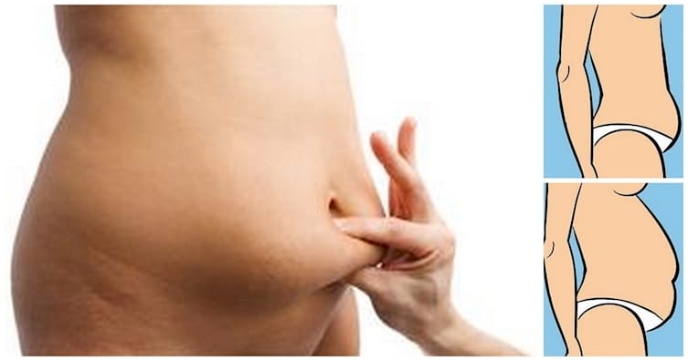 Learn Which Type of Belly Fat Do You Have And What To Do About It