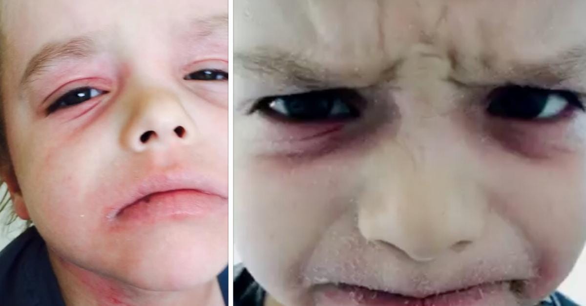 No Doctors Believe This Mom When She Tells Them What's Happening To Her 6-year-old Son