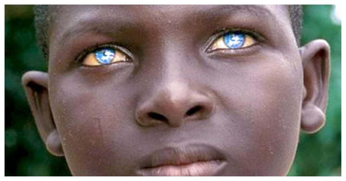 People Born With  Observable Human Characteristics That Are Simply Extraordinary.