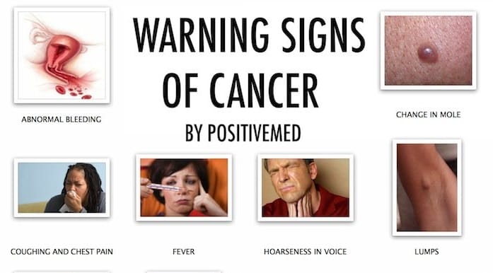 Signs That You Have Cancer