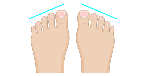 The Shape Of Your Feet Can Reveal Something Fascinating About Your Personality.