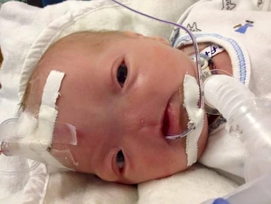This Baby Boy Was Born Without A Nose..And He's Absolutely ADORABLE.