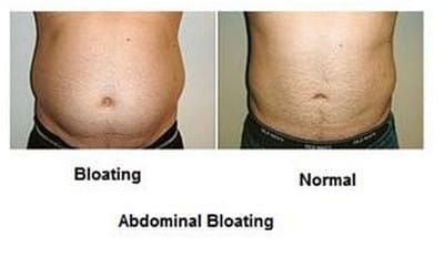 FINALLY - Lose Weight Overnight, Get Rid Of Your Bloated Belly And Why You Got It!