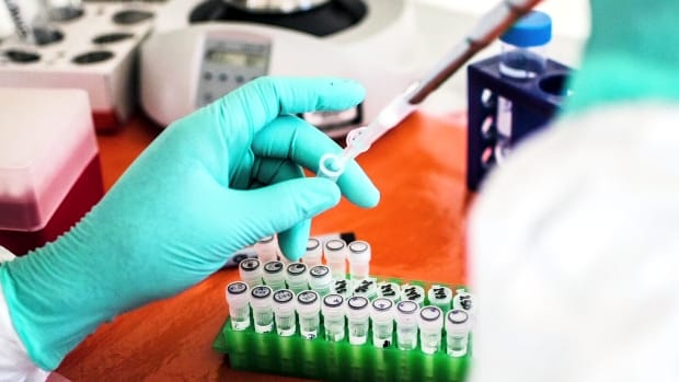 Top Facts About Ebola