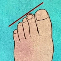 Your Toes Say A Lot About Your Personality