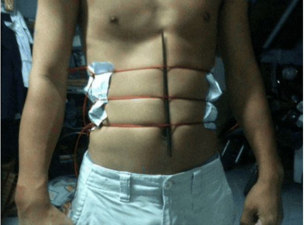 10 Crazy People Who Will Do Anything To Get Six Pack Abs !!