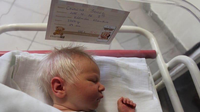 Doctors Finally Realize Why Newborn Baby Has Head Full Of Grey Hair