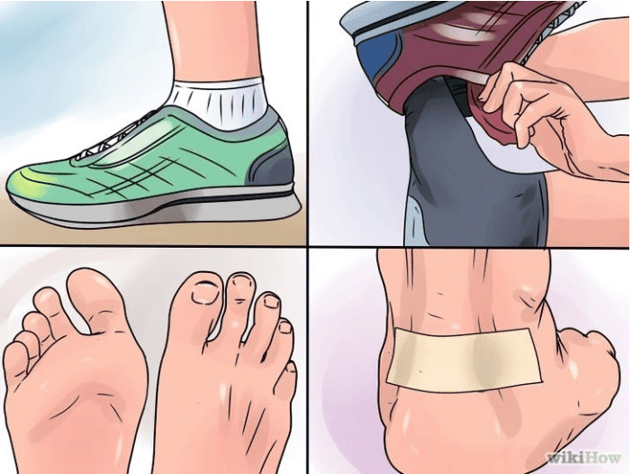 If You Have Blisters On Your Feet Don't Panic, Simply Follow These Instructions