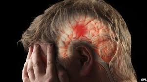 Here's How You Can Save A Person Having A Stroke With Just A Needle!