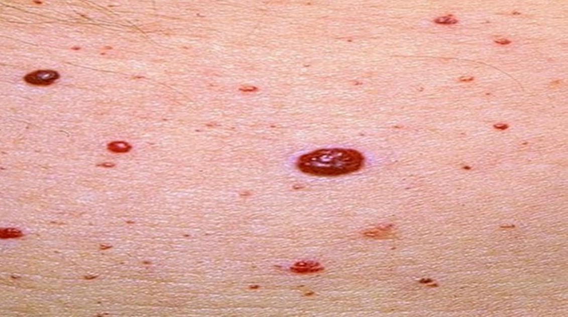 If You See These Red Spots On Your Skin, THIS Is What It Means!