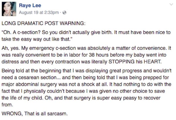 If You Think Getting A C-Section Is 'The Easy Way Out,' This Mom Has Something To Say To You