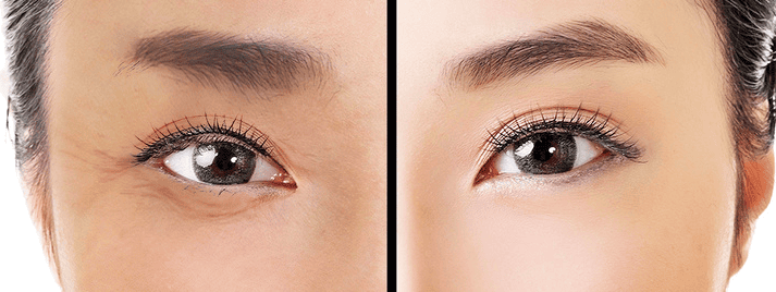 This Amazing Japanese 1 Minute Technique To Make Your Eyes Look Younger Is Easy