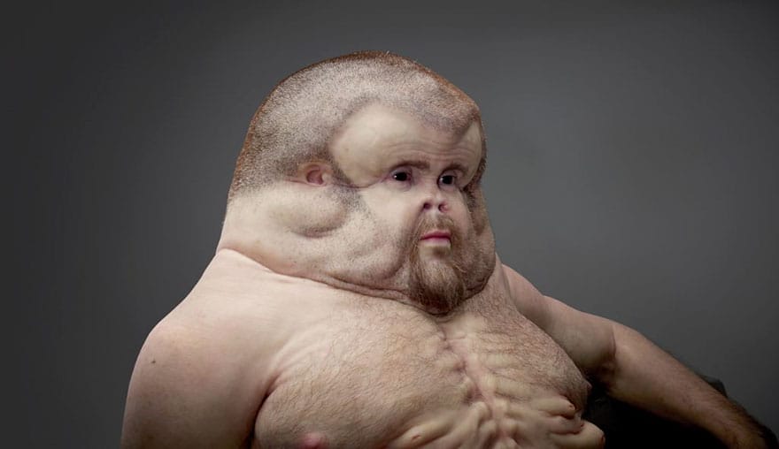 You will be shocked to see this man who can survive  a car crash.