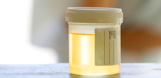 Your Urine Color Can Reveal Your Health Issues