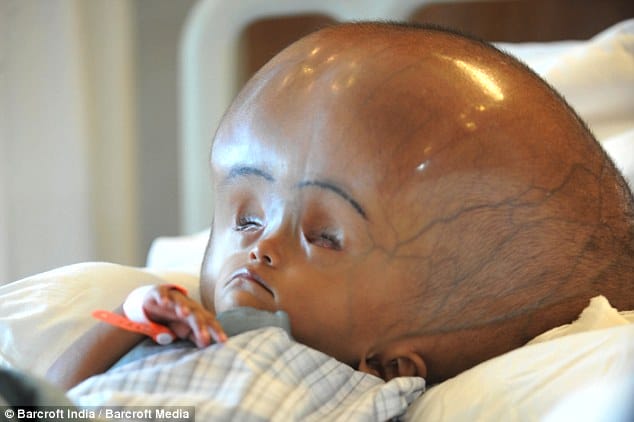 He Found This Baby In A Poor Village But Wait Till You See Her Face 2 Years Later