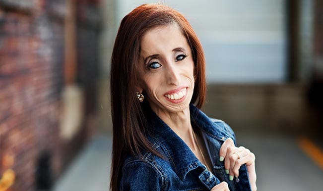 Lizie Valasquez Has A Word Or Two For Those Who Used Her Photo As A Meme