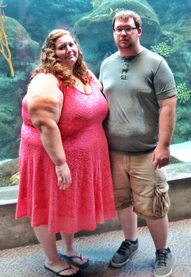 Obese Couple Shed Half Their Body Weight In Just One Year