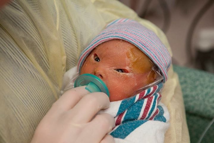 She Was Born With Special Abilities, Her Parents' Love Made Her Even More Special.