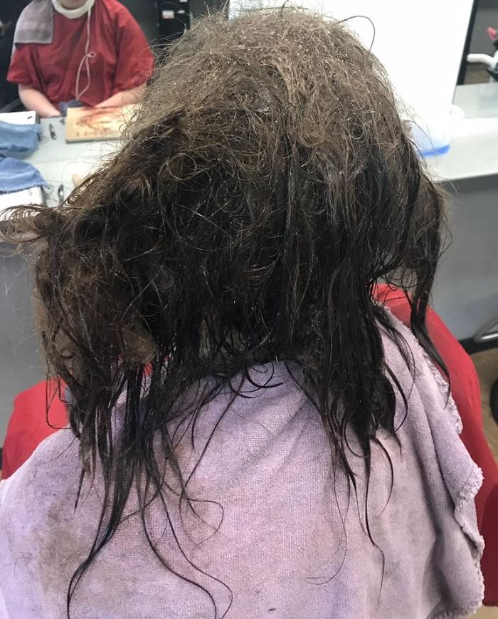 Teen's Hair Had To Be Shaved But The Hairdresser Spends 13 Hours Fixing It Instead