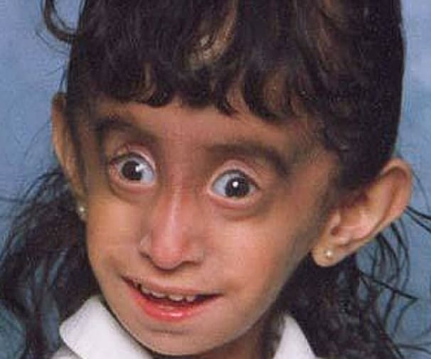 They Called Her The Ugliest Girl Ever. The Way She Took Those Comments Resulted In Something Beautiful.
