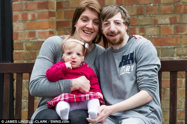 This Couple Were About To Have A Baby But Others Told Them Get It Aborted Because Of The Father's Condition!