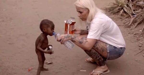 This Picture Broke The Hearts Of Many, But Then Hope Saved This Nigerian Kid In The Pic