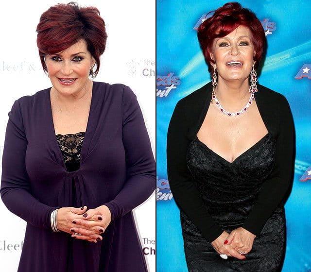Famous Hollywood Celebrities Whose Plastic Surgery Caused Them A Lifetime Of Embarrassment