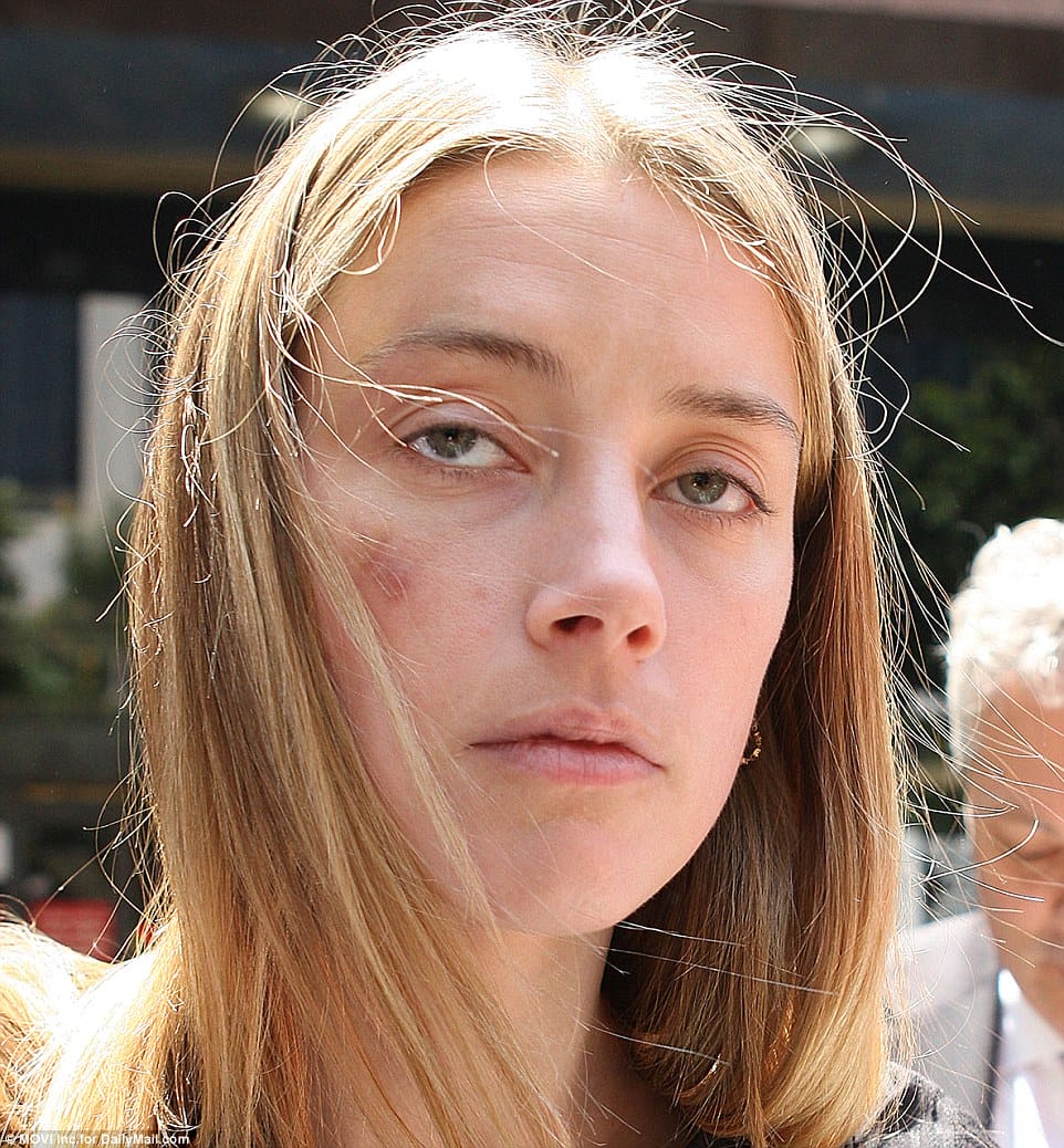 Amber Heard Claims Domestic Violence From Johnny Depp. Pictures Inside