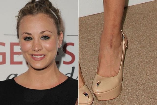Scarred Celebrities Have Incredible Stories About Their Famous Marks
