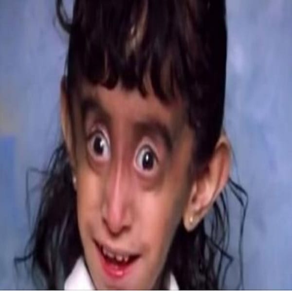 She Was Always Told She Was The Ugliest Girl Ever. What She Looks Like Now? This Is Amazing!