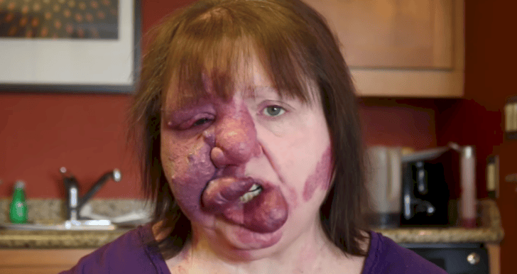 This Woman Born With A Birth Defect Gets A Makeover Of A Lifetime. This Is How She Looks Now