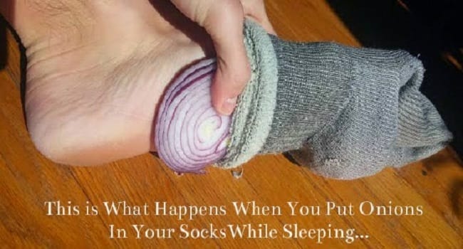 This is What Happens When You Put Cut Up Onions in Your Socks While You Sleep