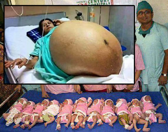 Indiana Woman Gives Birth To 11 Baby Boys WITHOUT C Section Delivery