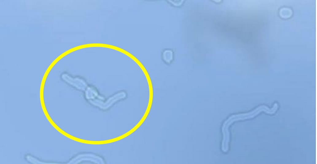 The Fascinating Reason Why You Occasionally See Things Floating In Your Eyes