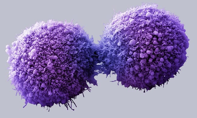 The Skin Cancer Detector That Could Save Your Life