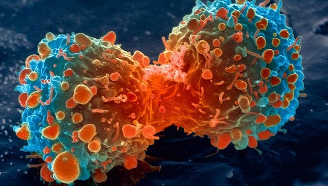 This Ancient Herb That Kills Cancer Cells Is Gaining Renewed Importance